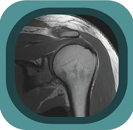 mri shoulder anatomy icon